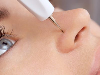 IPL_ClinicaLlado IPL_ClinicaLlado
