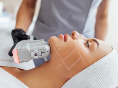 HifuFacial_ClinicaLlado HifuFacial_ClinicaLlado