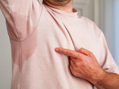 Hiperhidrosis_hombre Hiperhidrosis_hombre