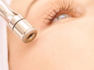 Microdermoabrasion_ClinicaLlado Microdermoabrasion_ClinicaLlado